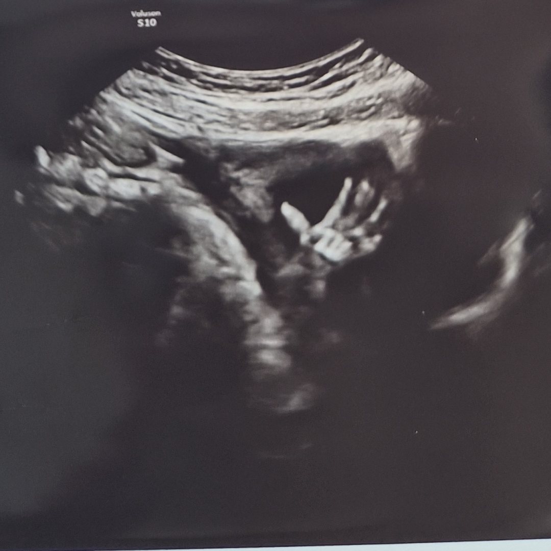Photo shared by Tiara for their Babylist baby registry.