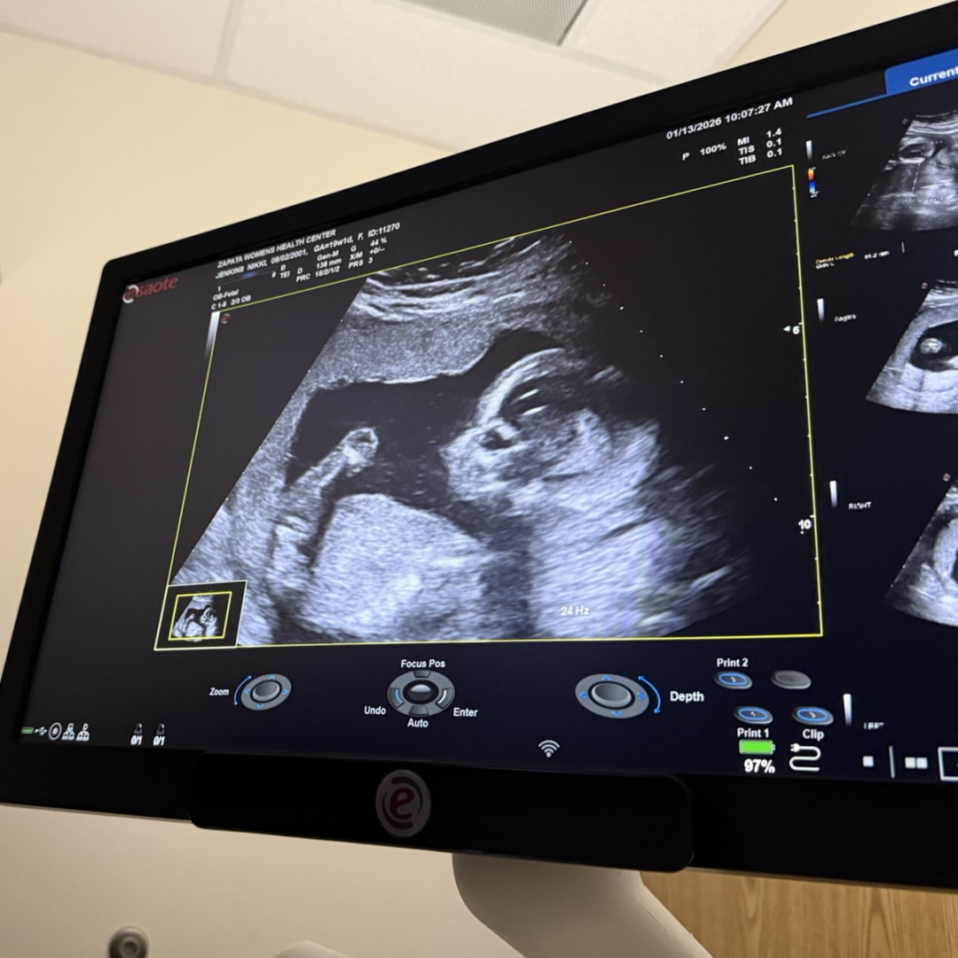 Photo shared by Nikki for their Babylist baby registry.