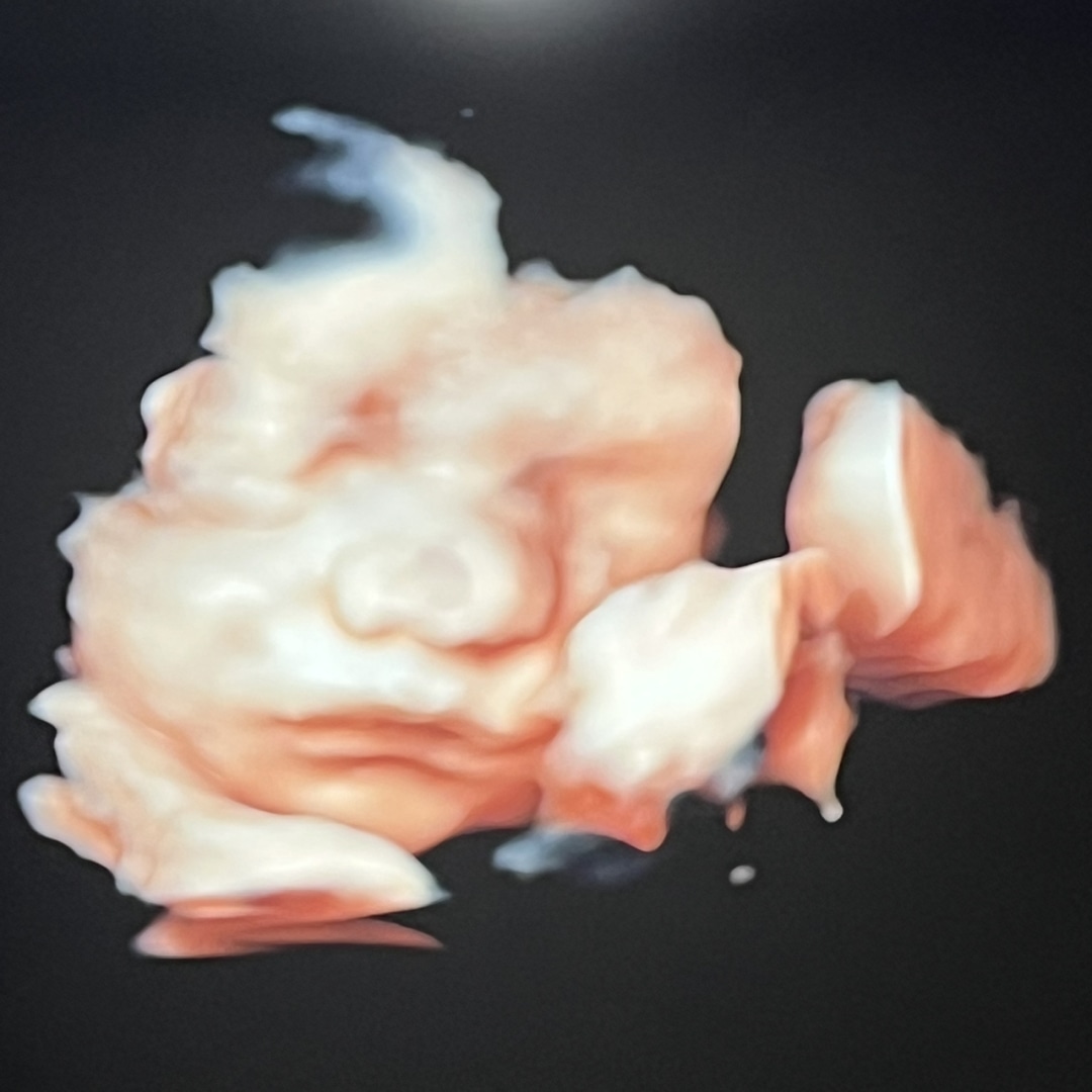 Photo shared by Desirae for their Babylist baby registry.
