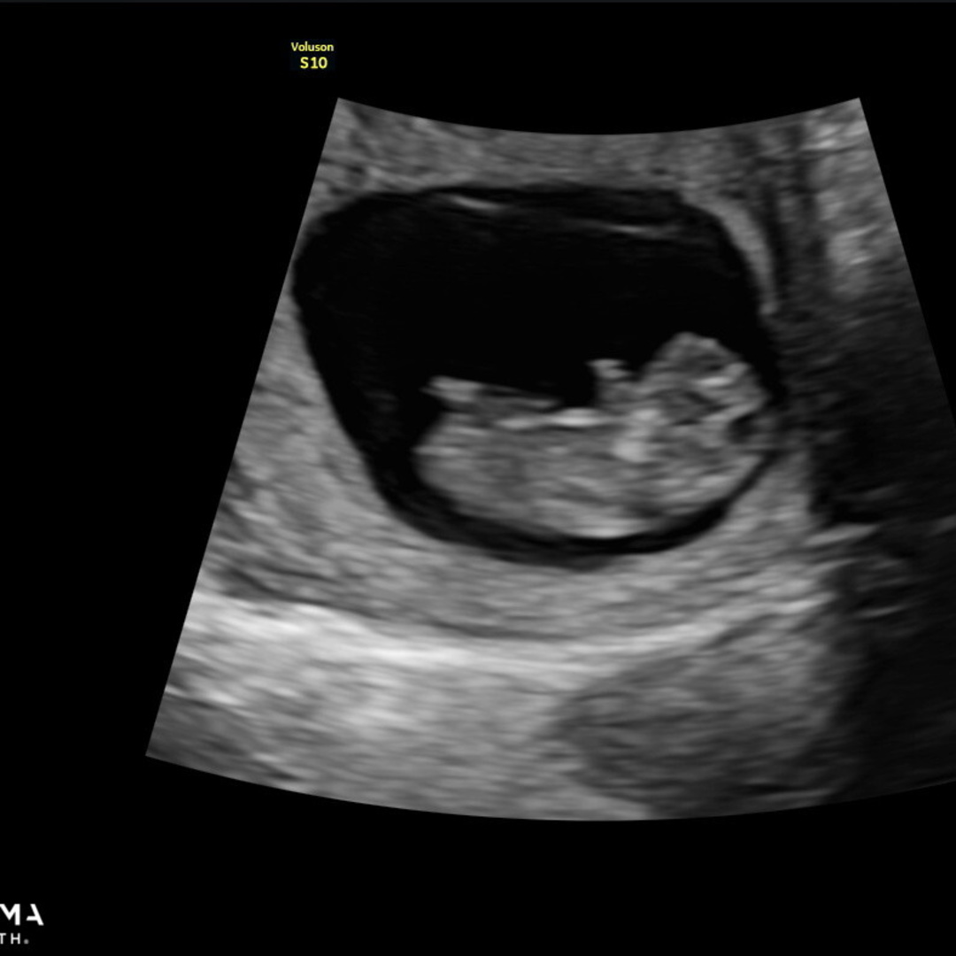 Photo shared by Dani for their Babylist baby registry.