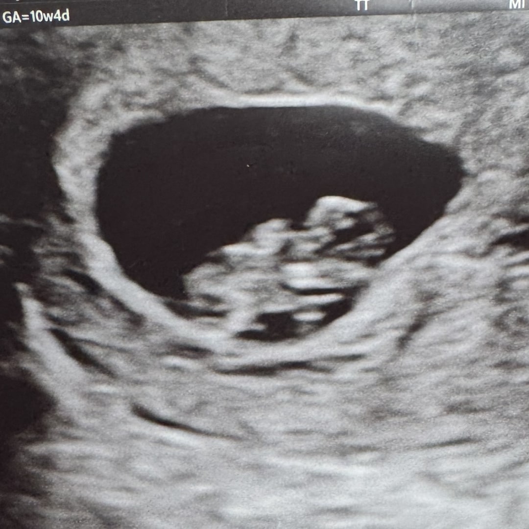 Photo shared by Whitney for their Babylist baby registry.