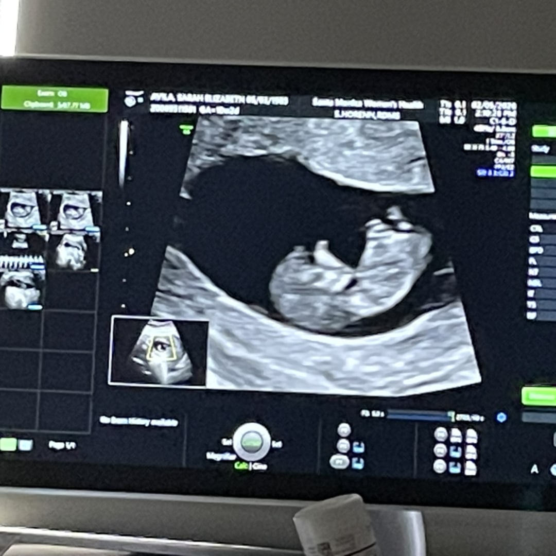 Photo shared by Sarah for their Babylist baby registry.