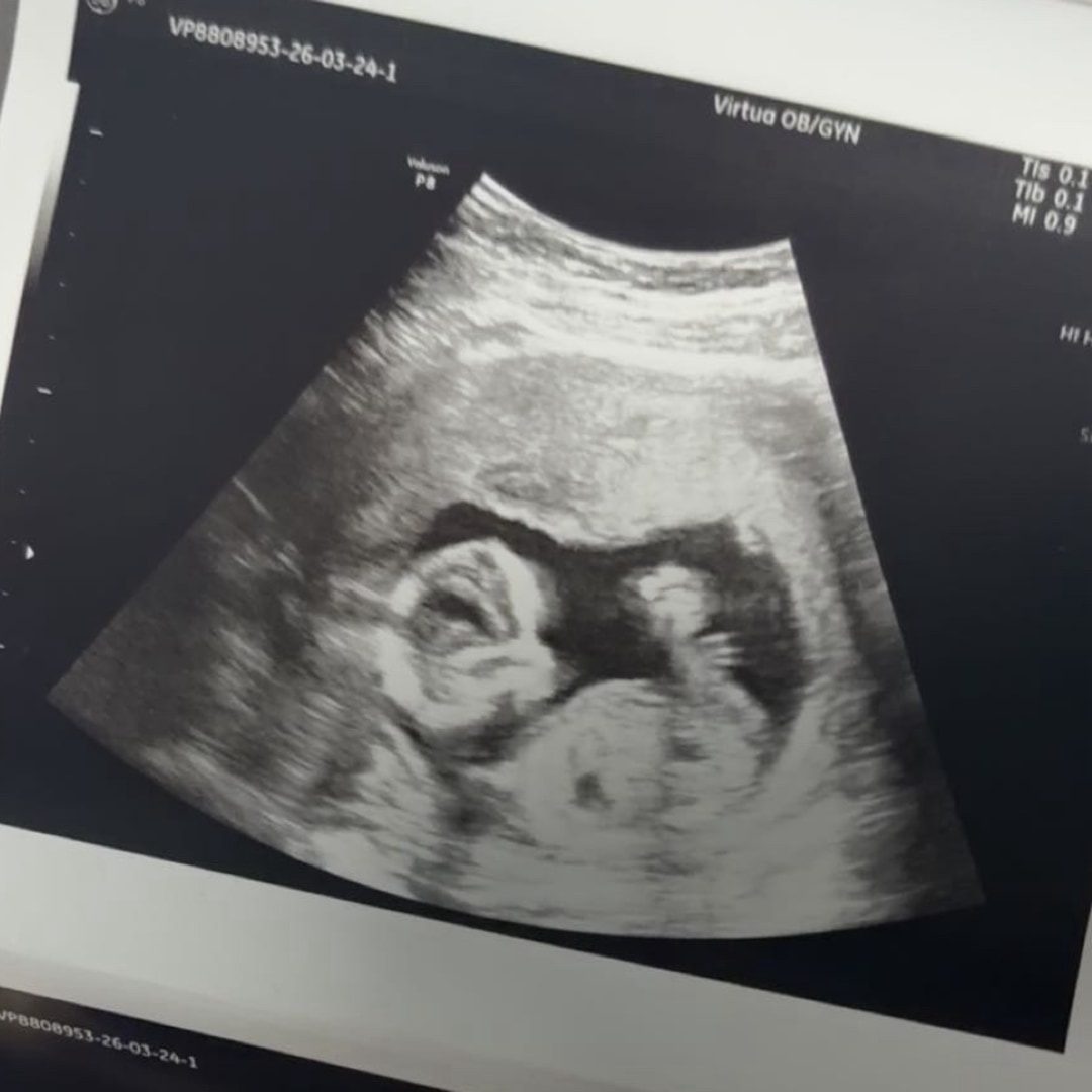 Photo shared by MacKenzie for their Babylist baby registry.