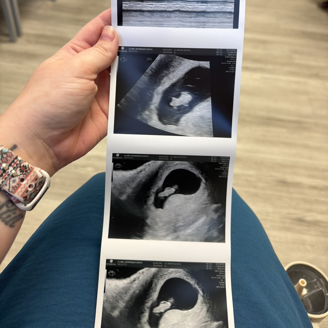 Photo shared by Dominique for their Babylist baby registry.