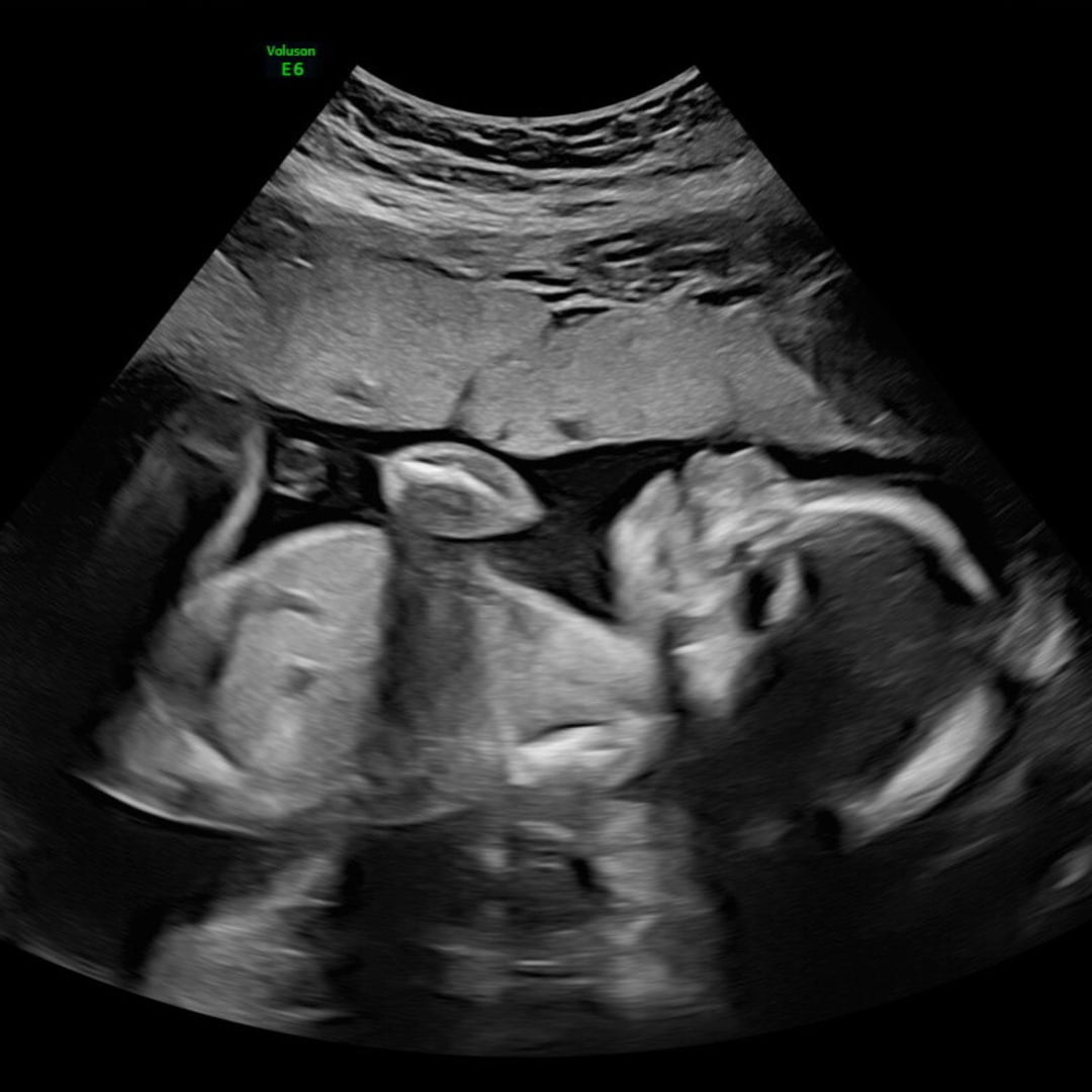 Photo shared by Abigail for their Babylist baby registry.