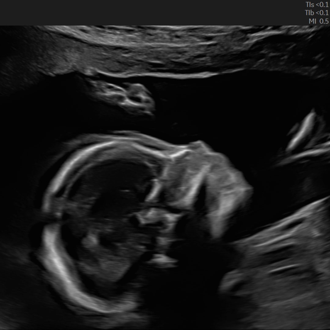 Photo shared by Shelby for their Babylist baby registry.