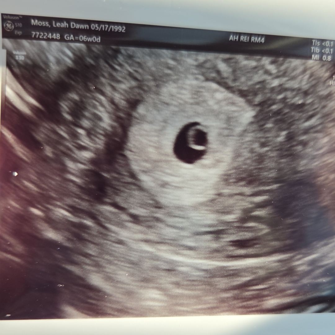 Photo shared by Leah Dawn for their Babylist baby registry.
