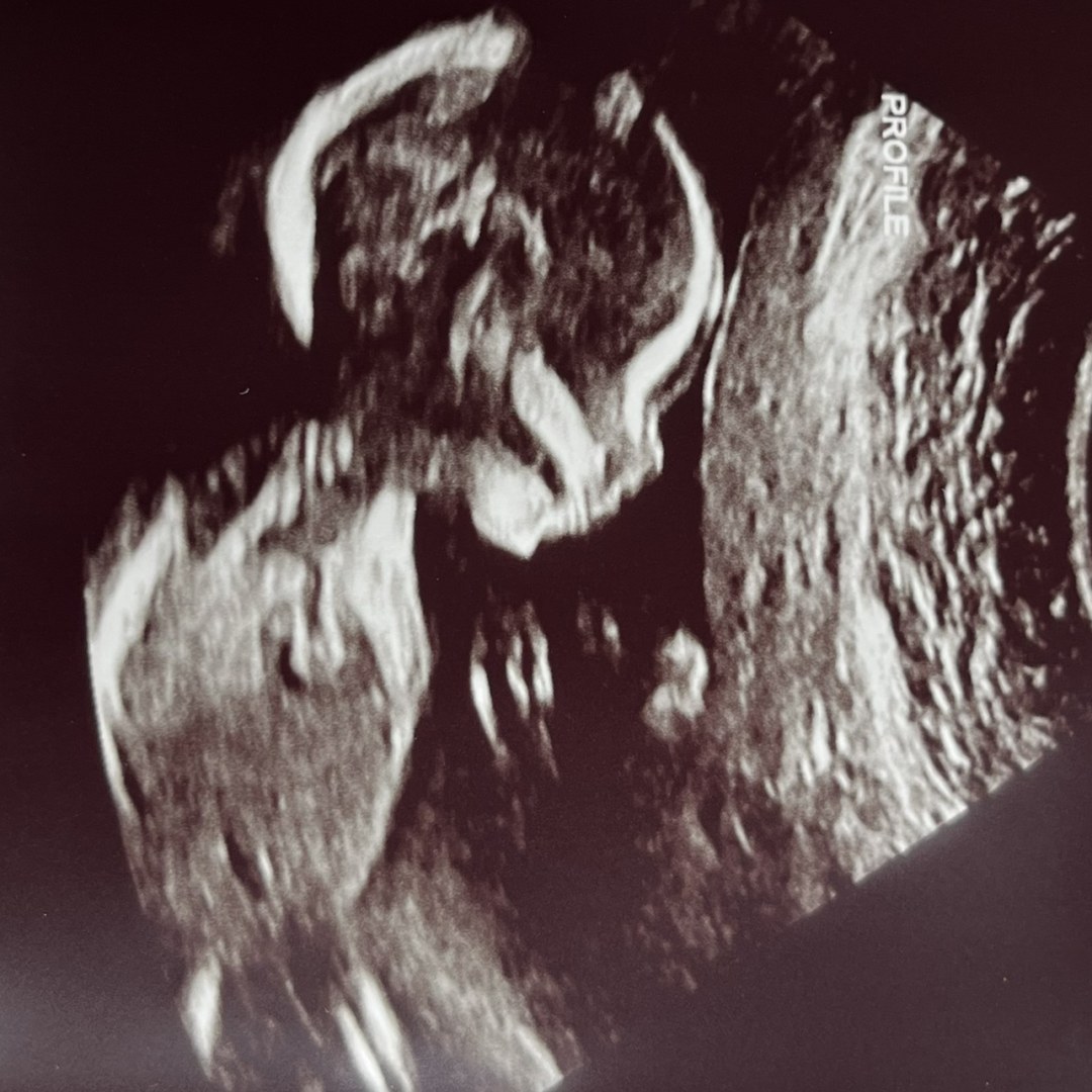 Photo shared by Elvira Marien for their Babylist baby registry.