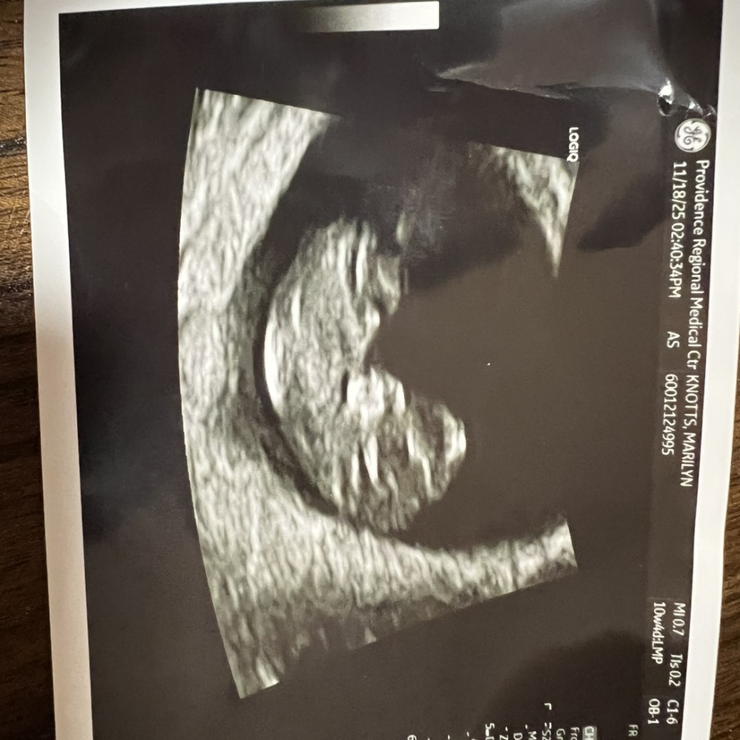 Photo shared by Marilyn for their Babylist baby registry.