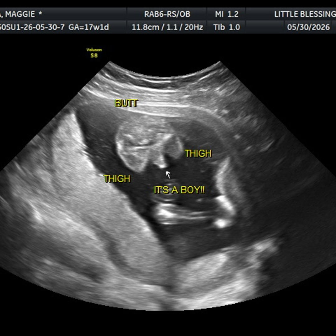 Photo shared by Alan for their Babylist baby registry.