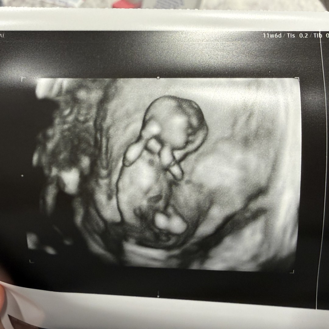 Photo shared by Breyauna for their Babylist baby registry.