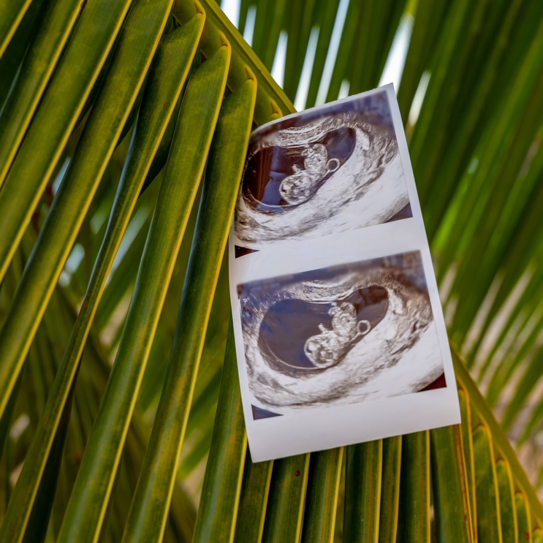 Photo shared by Monika for their Babylist baby registry.