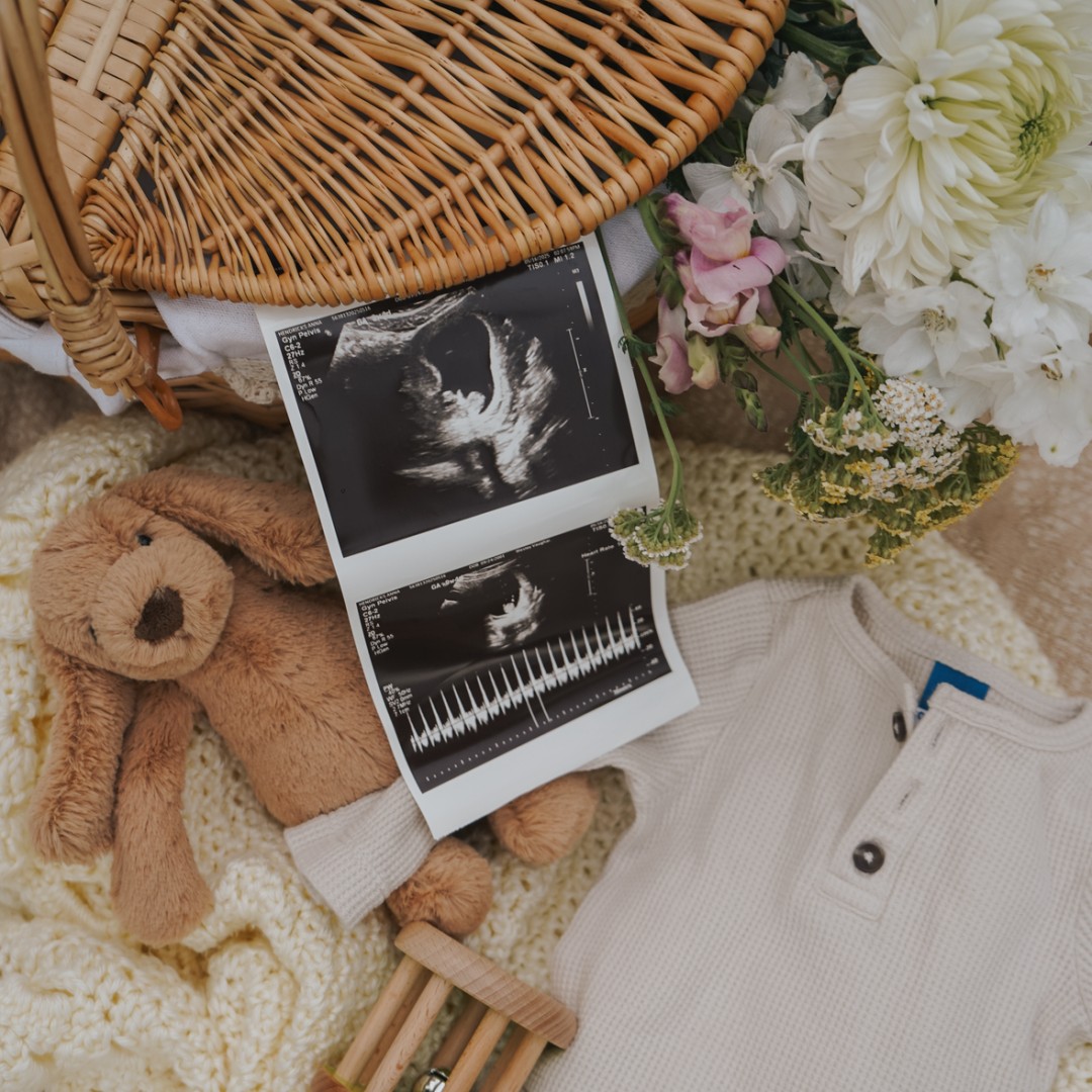 Photo shared by Kate for their Babylist baby registry.