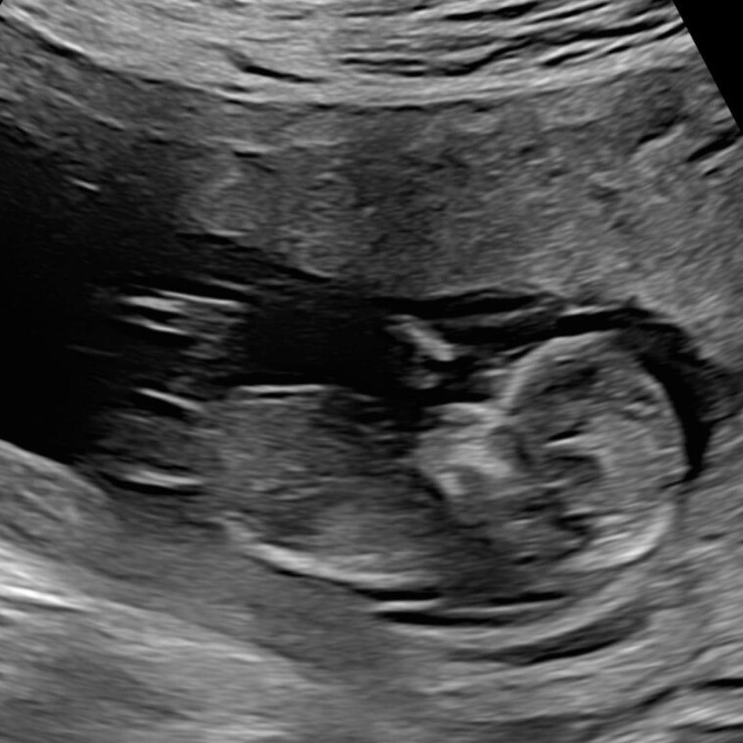 Photo shared by Jaylon for their Babylist baby registry.