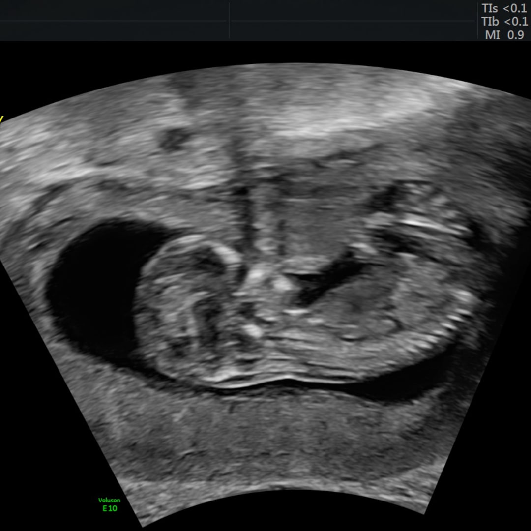 Photo shared by Imani for their Babylist baby registry.