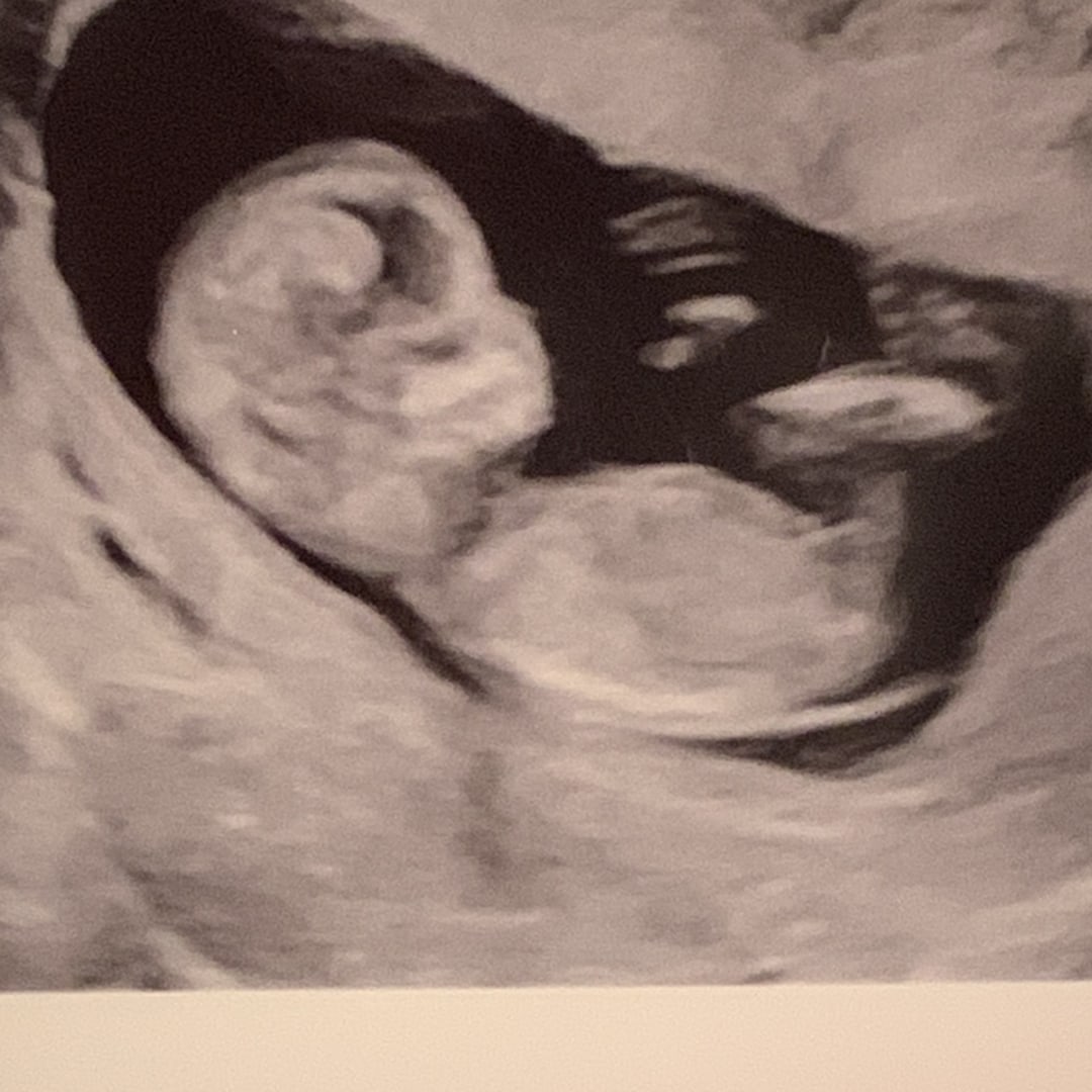 Photo shared by Geraldine for their Babylist baby registry.