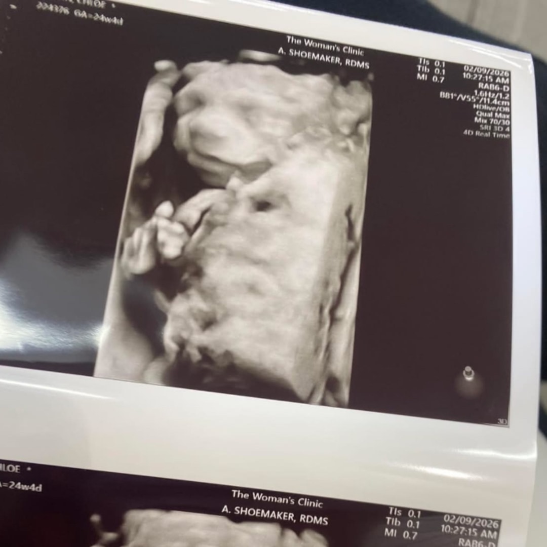 Photo shared by Chloe for their Babylist baby registry.