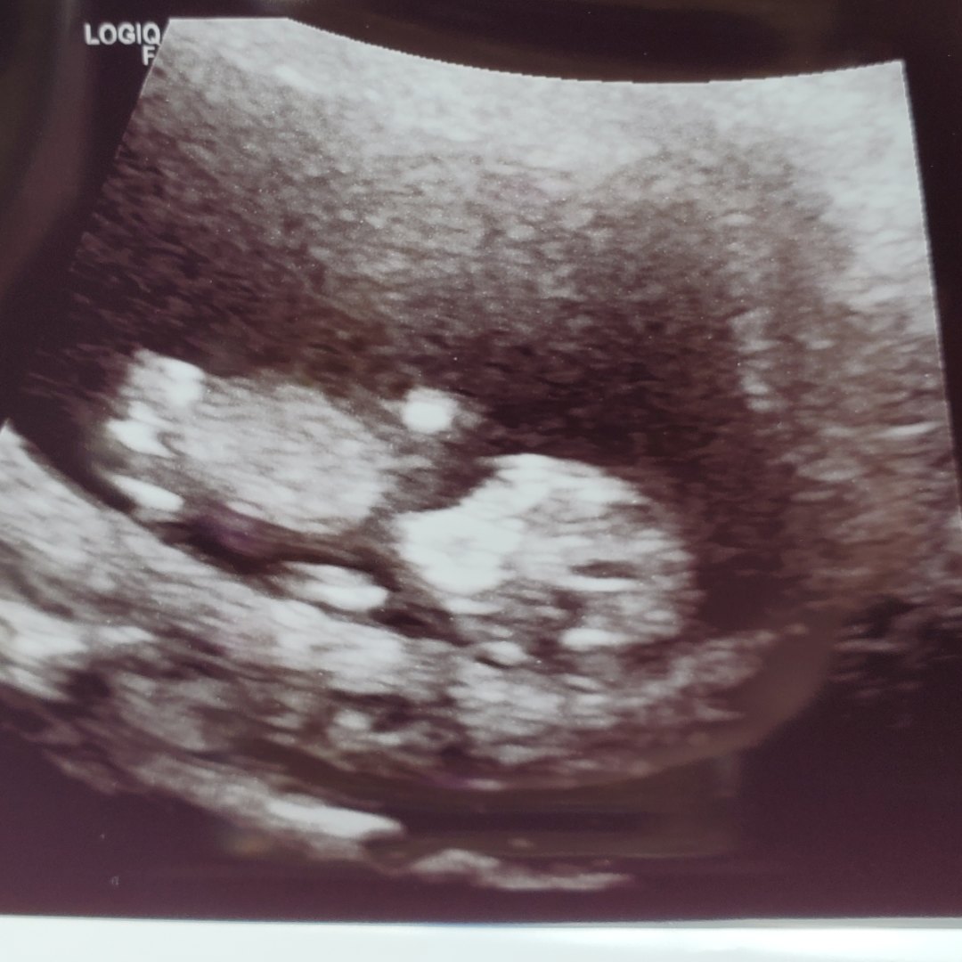 Photo shared by Megan for their Babylist baby registry.