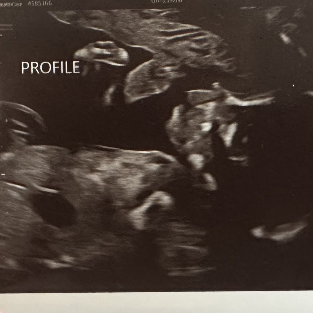 Photo shared by Everbless for their Babylist baby registry.