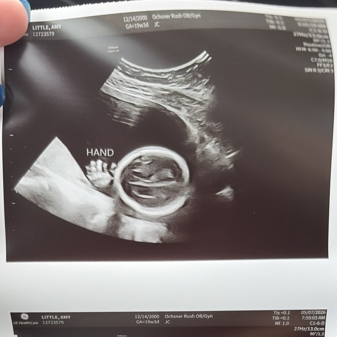 Photo shared by Amy for their Babylist baby registry.