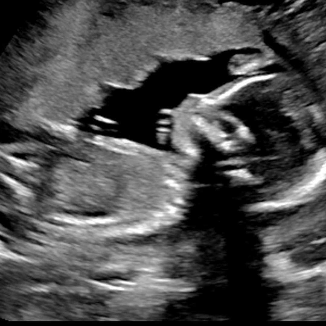 Photo shared by Samantha for their Babylist baby registry.