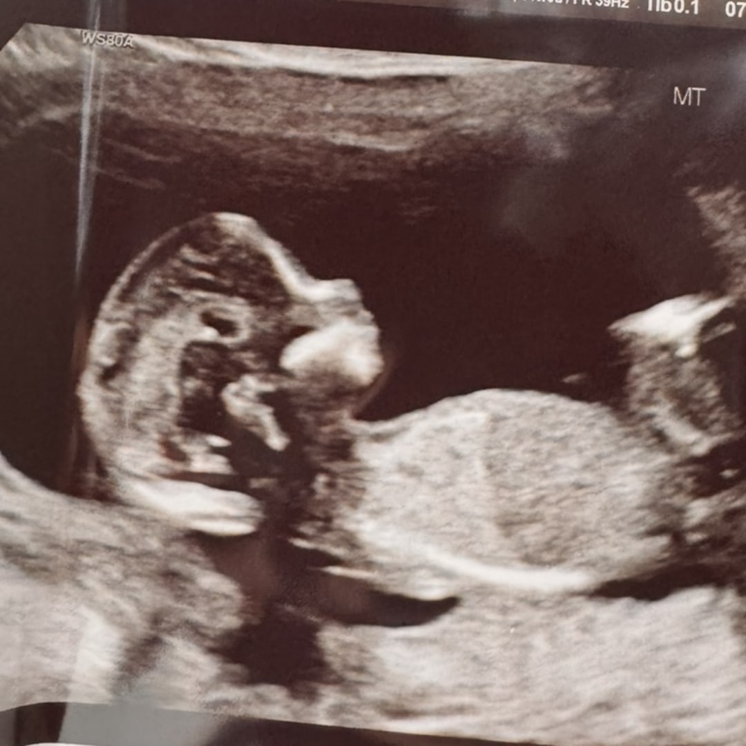 Photo shared by Devin for their Babylist baby registry.