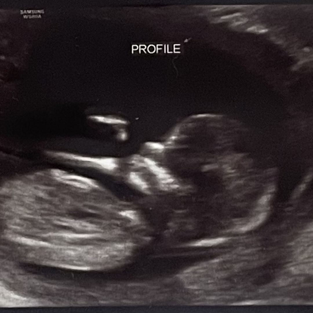 Photo shared by Jasmin for their Babylist baby registry.