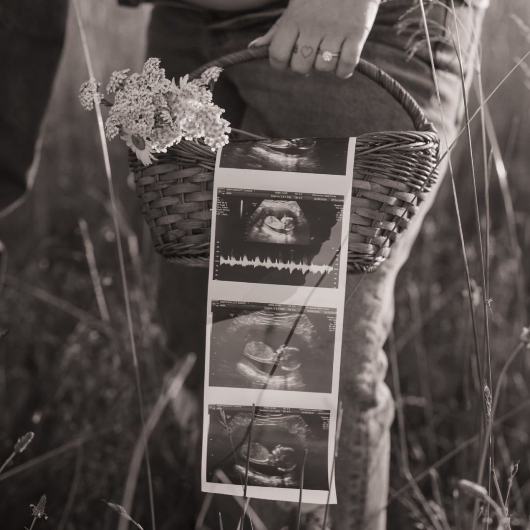 Photo shared by Jadyn for their Babylist baby registry.