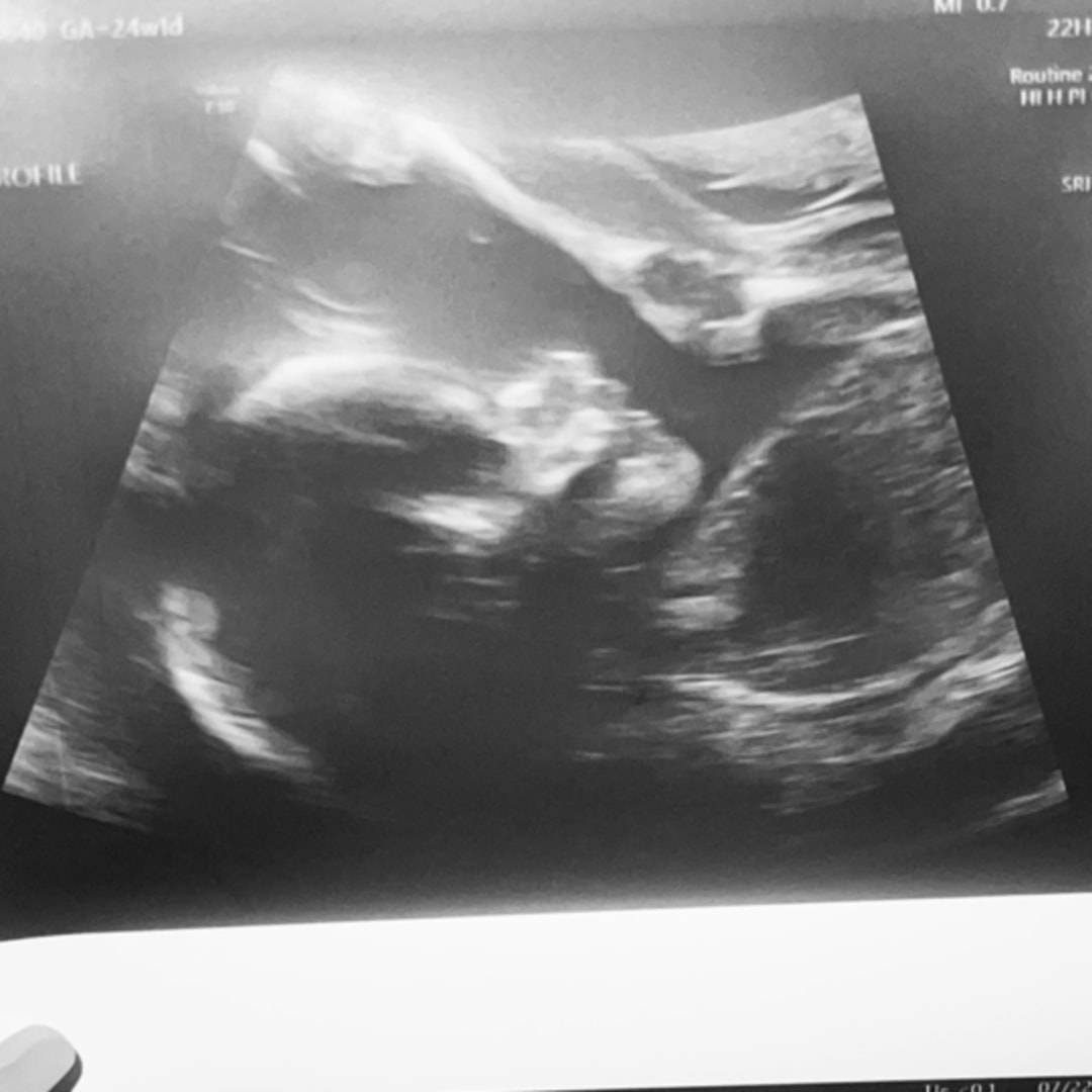 Photo shared by Karina for their Babylist baby registry.