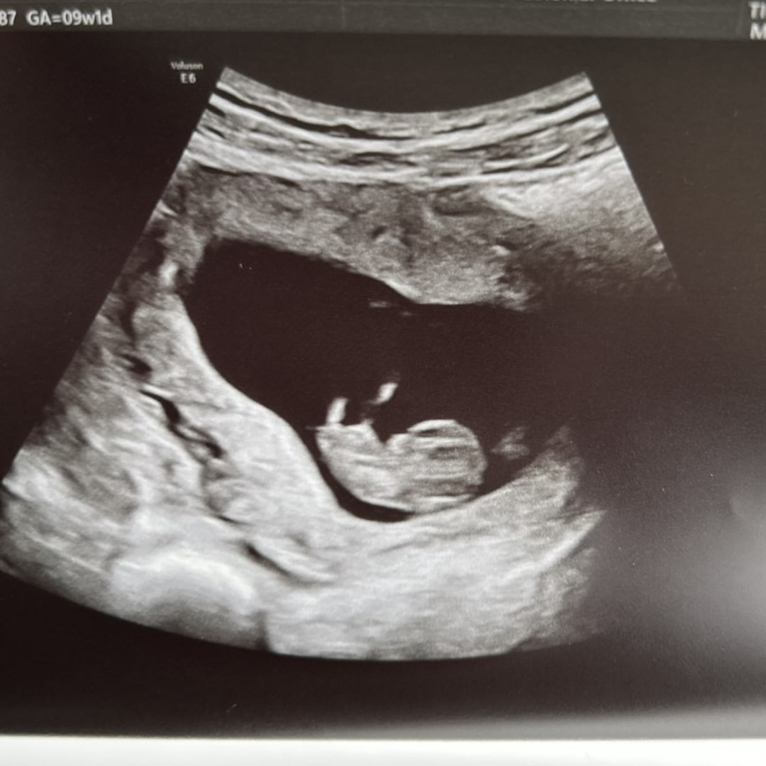 Photo shared by Jenna for their Babylist baby registry.