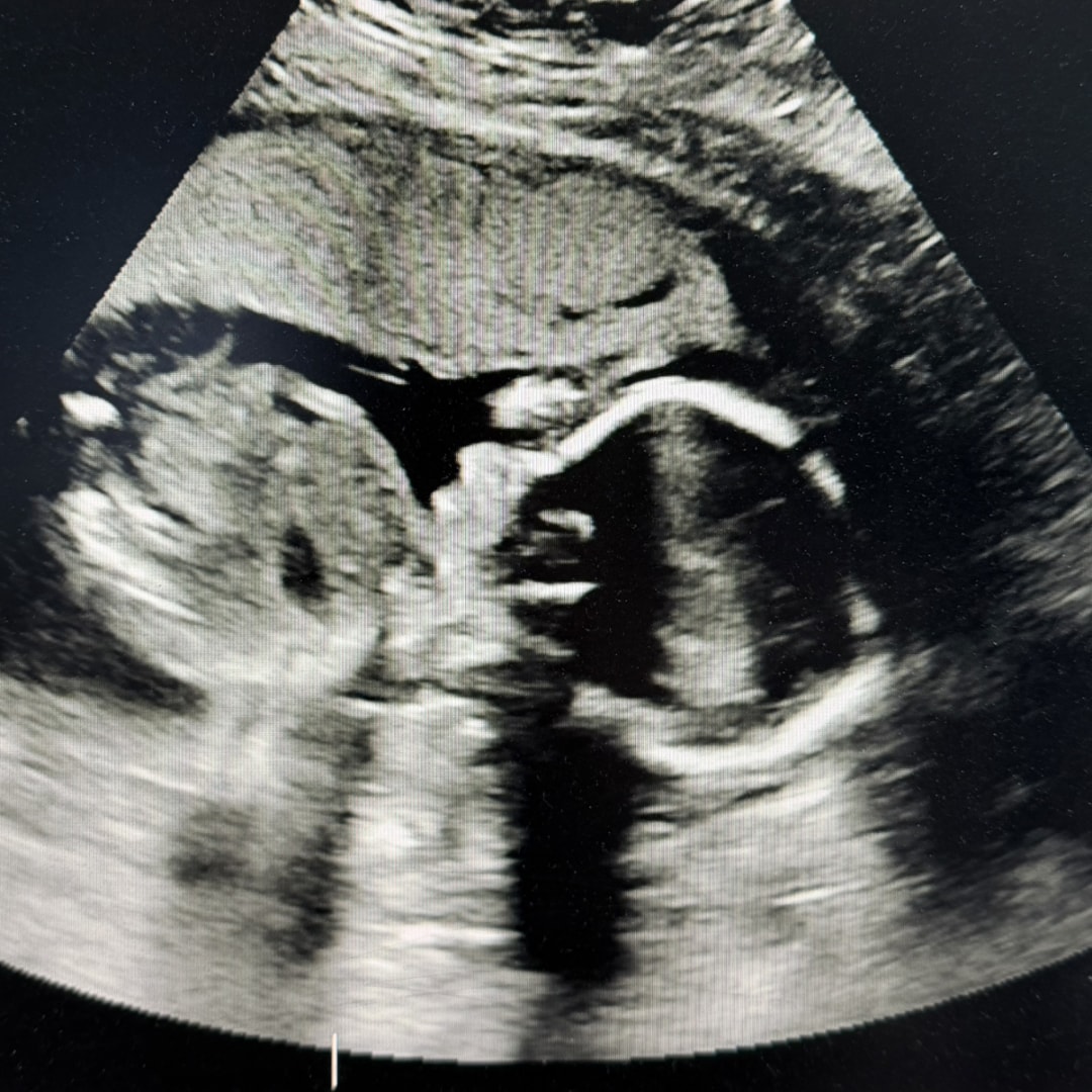 Photo shared by Cassie for their Babylist baby registry.