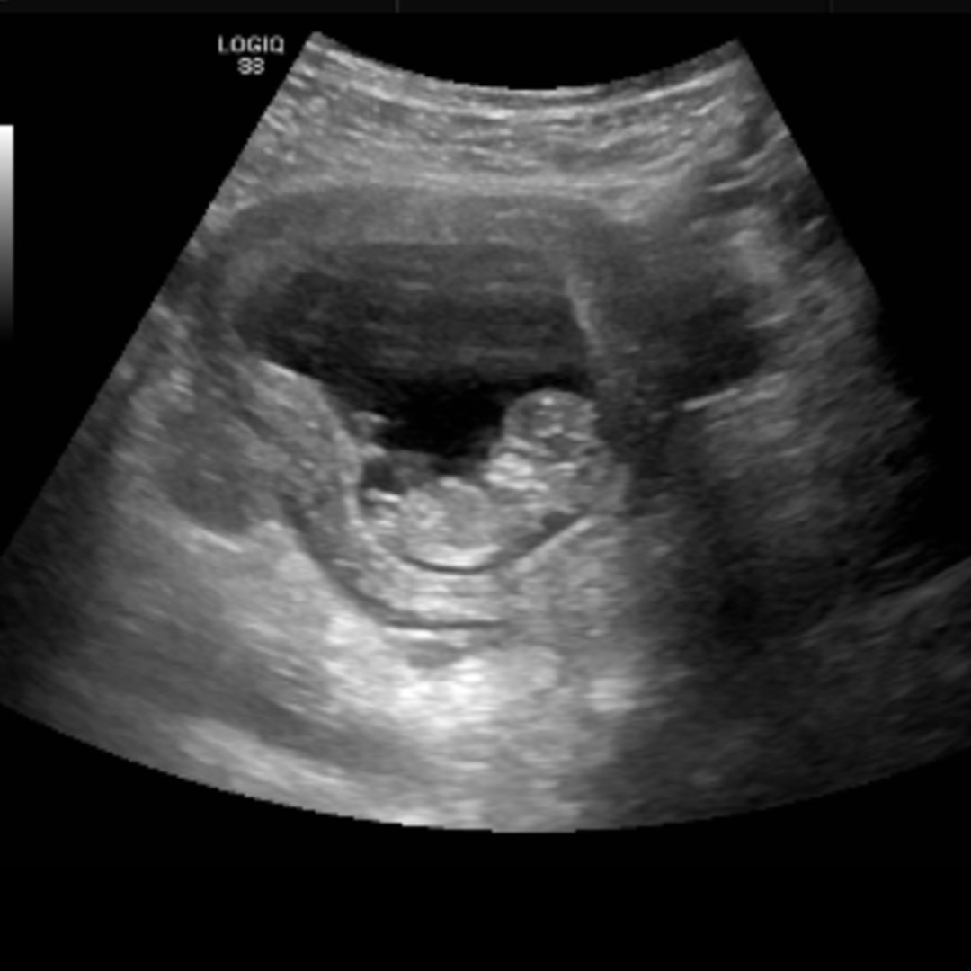 Photo shared by Jessi for their Babylist baby registry.