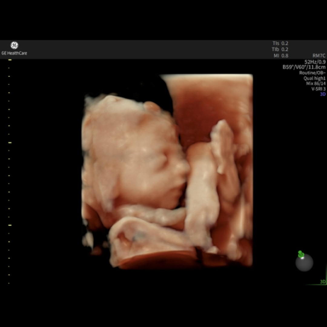 Photo shared by Hunter for their Babylist baby registry.