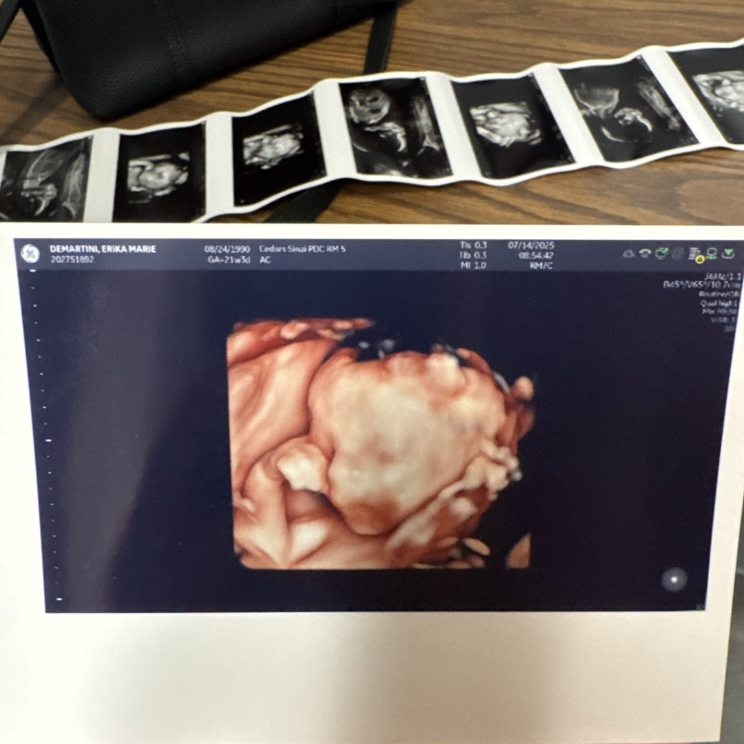 Photo shared by Erika for their Babylist baby registry.