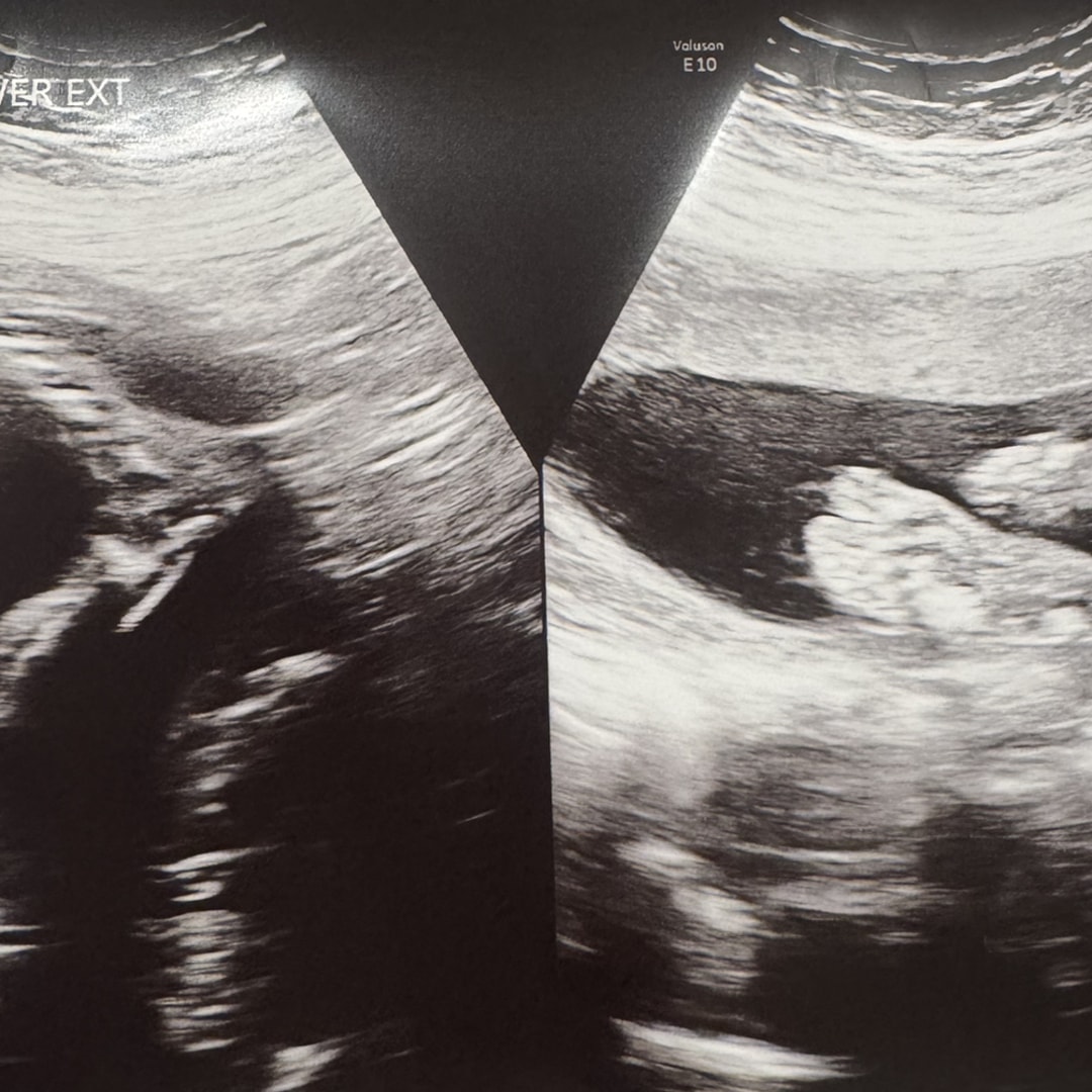 Photo shared by Marina for their Babylist baby registry.