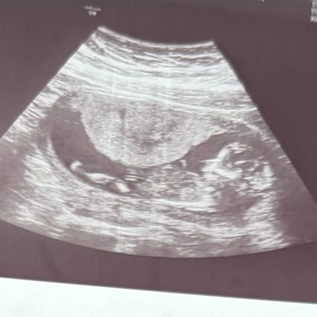 Photo shared by Kathryn for their Babylist baby registry.