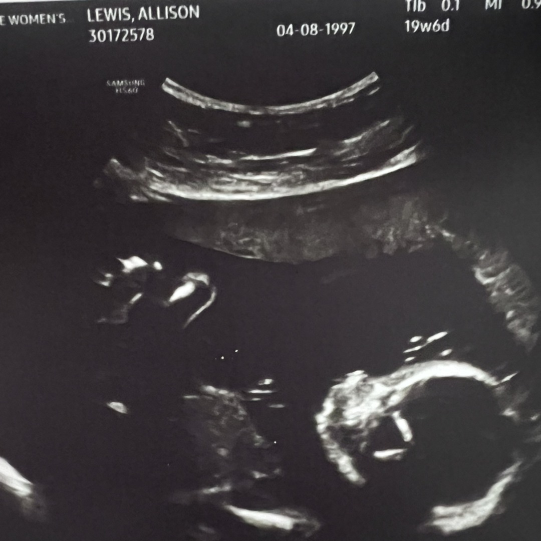 Photo shared by Alli for their Babylist baby registry.