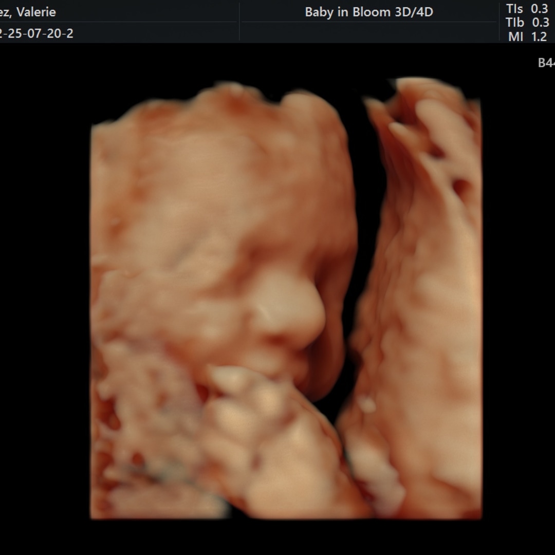 Photo shared by Valerie for their Babylist baby registry.