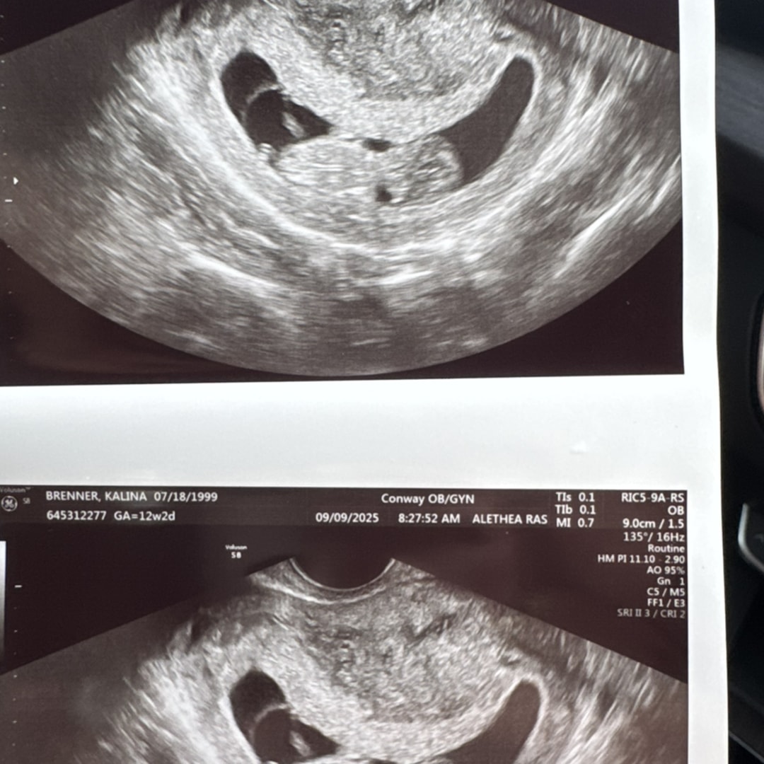 Photo shared by Kalina for their Babylist baby registry.