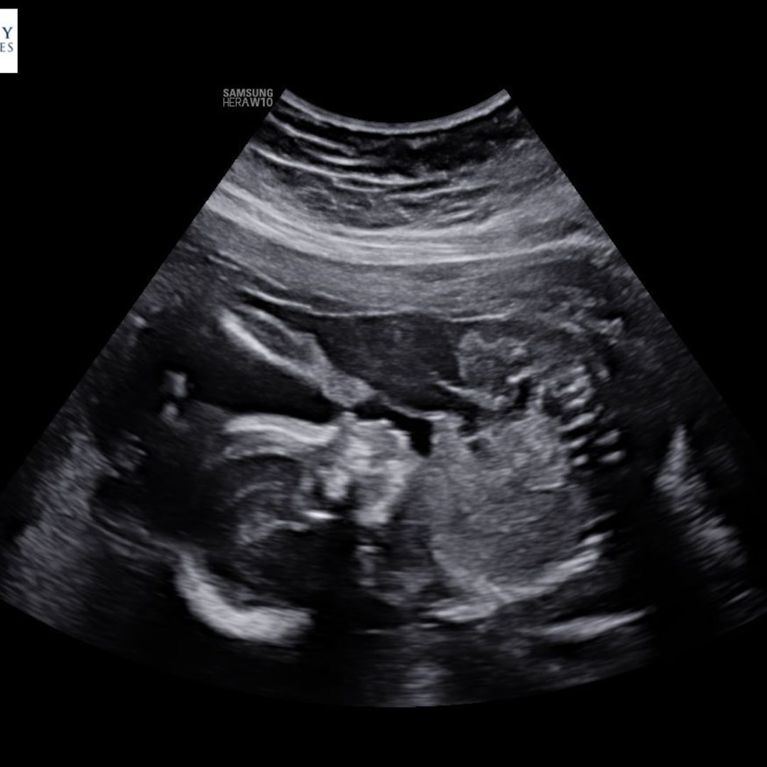 Photo shared by Kaylee for their Babylist baby registry.