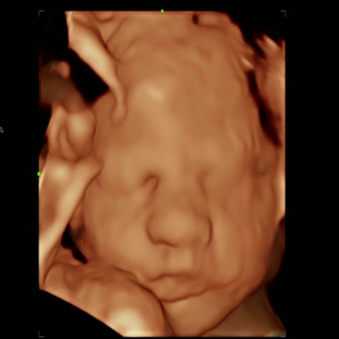 Photo shared by Emily for their Babylist baby registry.