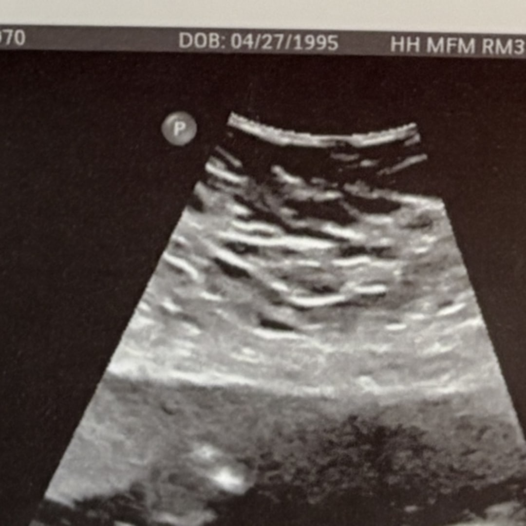 Photo shared by Cassidy for their Babylist baby registry.