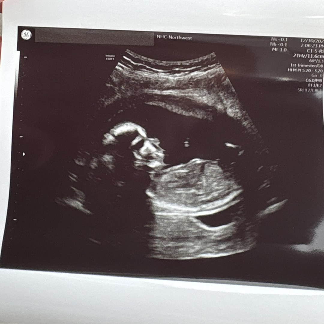 Photo shared by Shalyce for their Babylist baby registry.