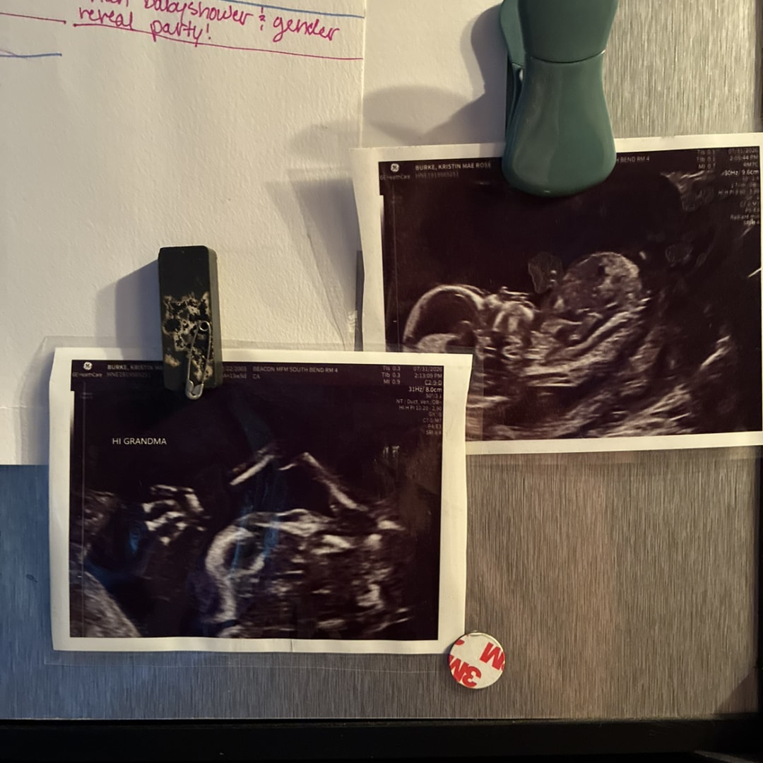 Photo shared by Kristin for their Babylist baby registry.