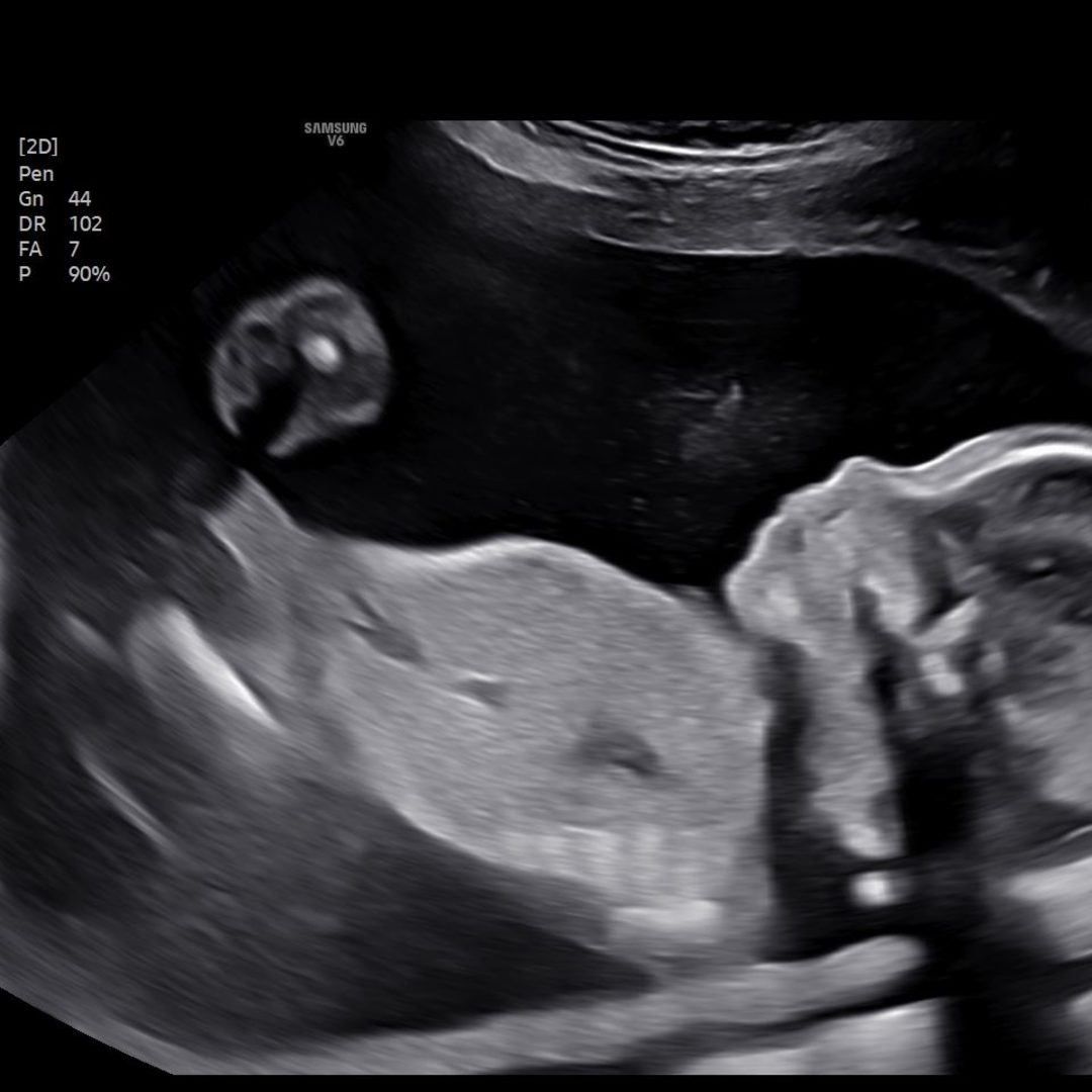 Photo shared by Angie for their Babylist baby registry.