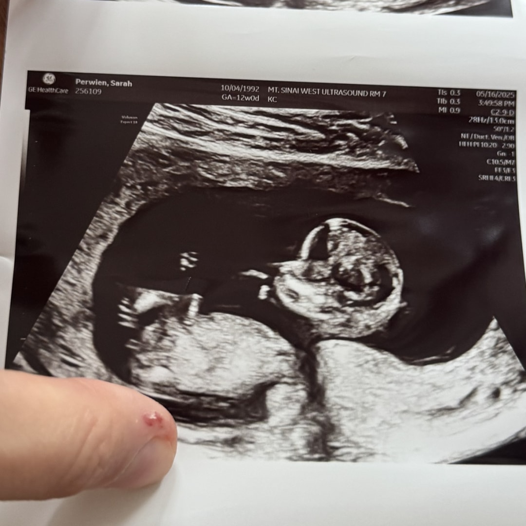 Photo shared by Sarah for their Babylist baby registry.