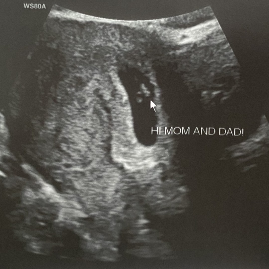 Photo shared by Caitlin for their Babylist baby registry.