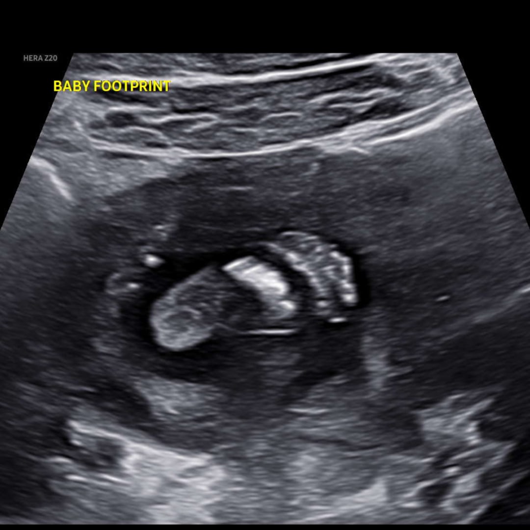 Photo shared by Priscilla for their Babylist baby registry.
