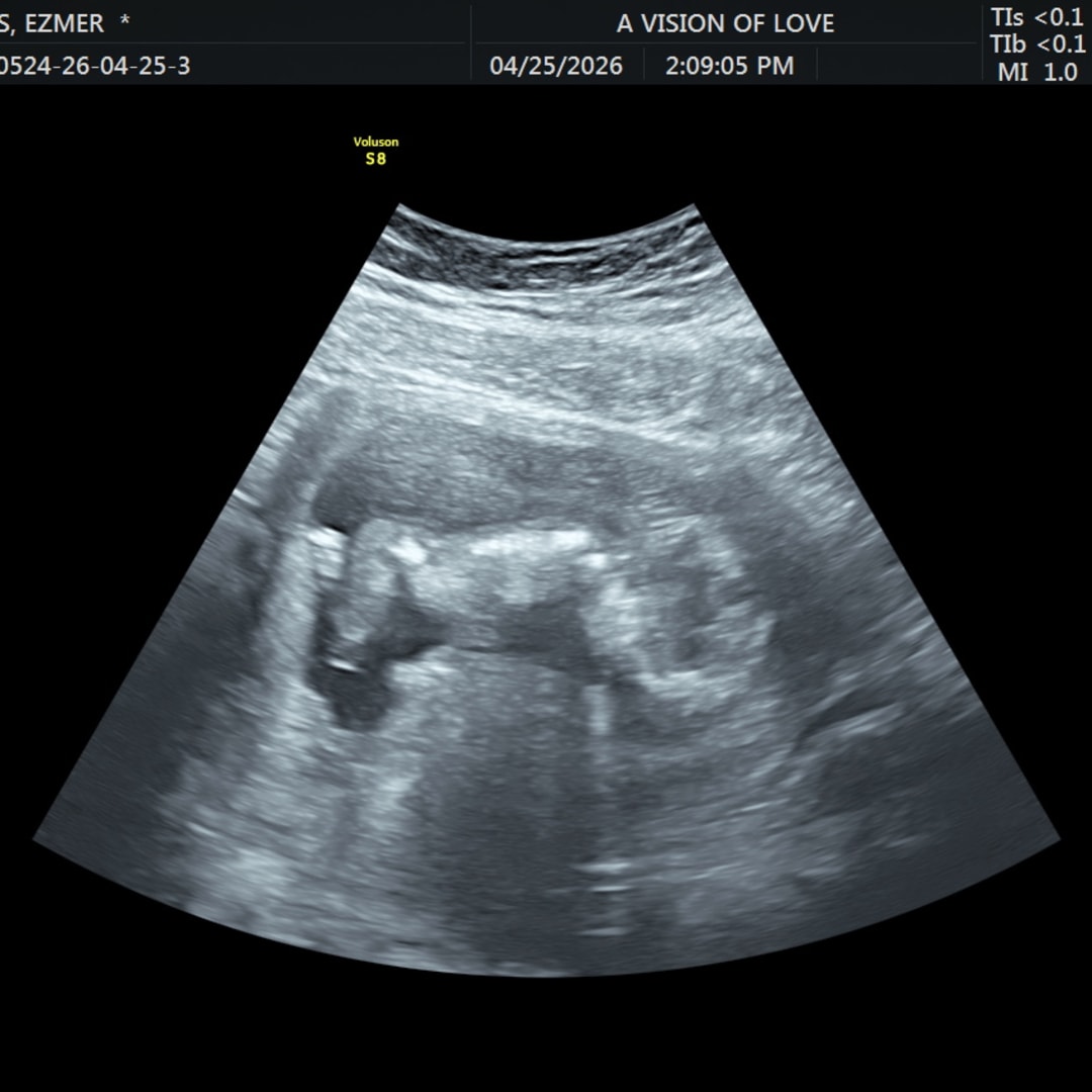 Photo shared by Ezmer for their Babylist baby registry.