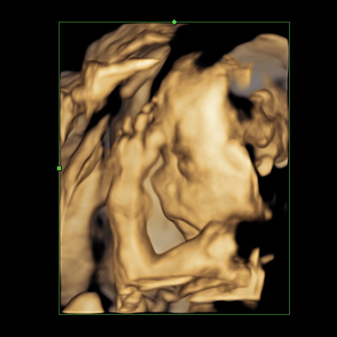 Photo shared by Daniell for their Babylist baby registry.